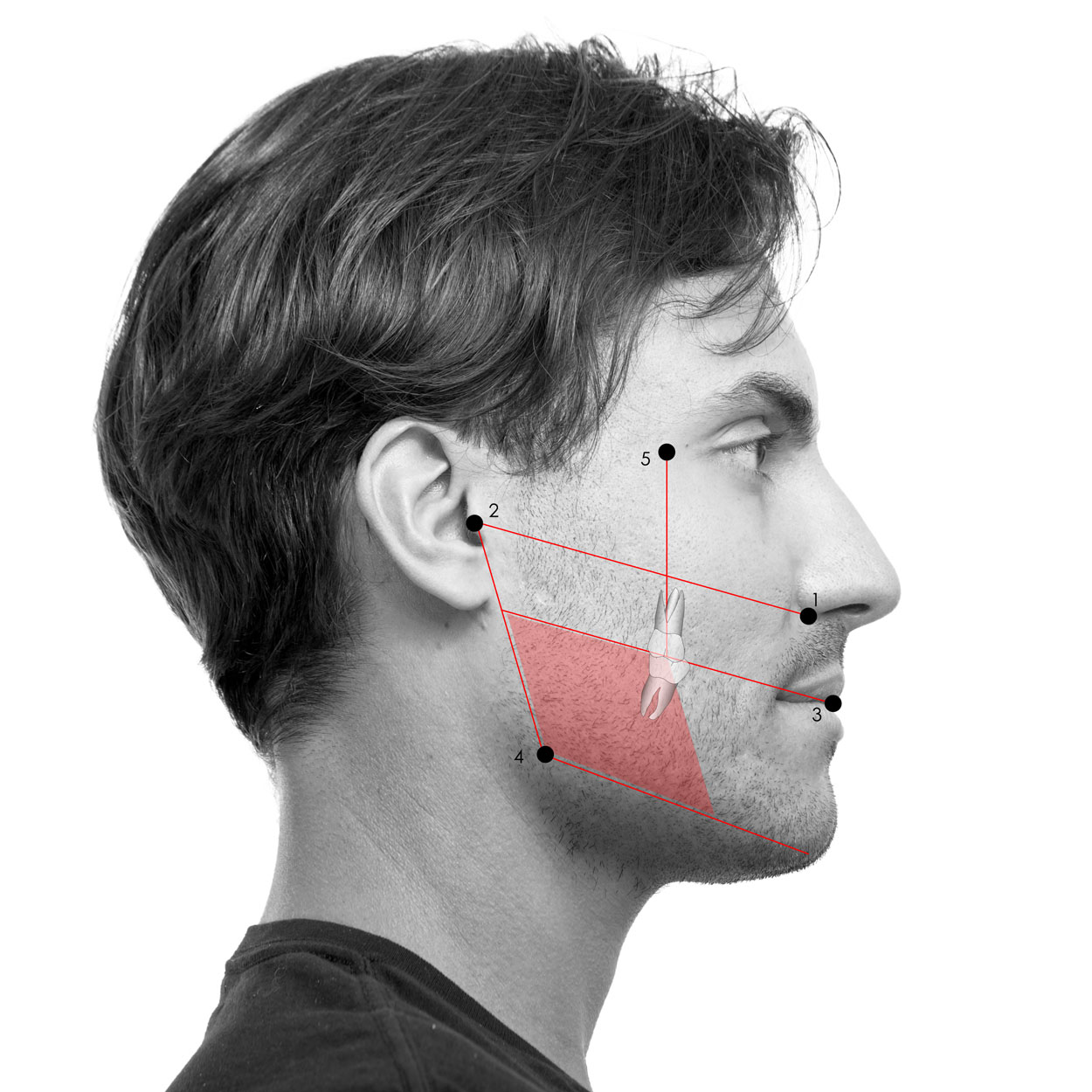 Seitliche Gesichtsanalyse eines männlichen Patienten der viel Höhe verträgt