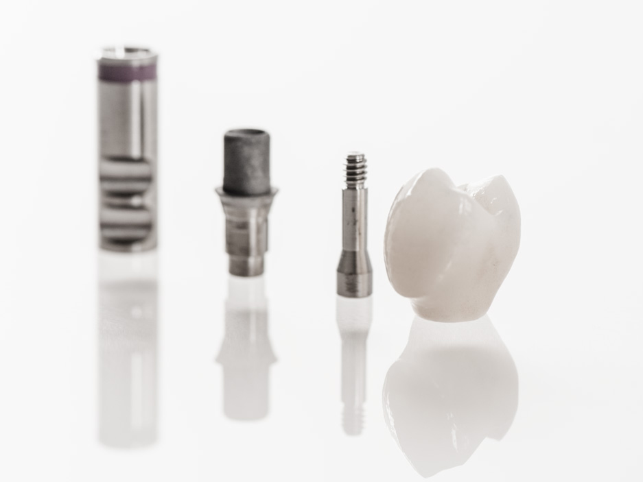 verschraubte Implantatkrone Einzelteile