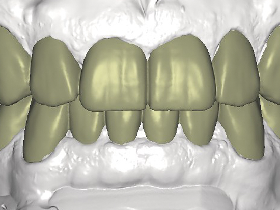 Digitale Aufstellung - Planung
