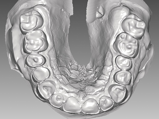 Draufsicht von oben auf die Zahnreihen im Unterkiefer