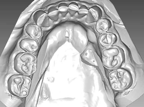 Draufsicht von oben auf die Zahnreihen im Unterkiefer